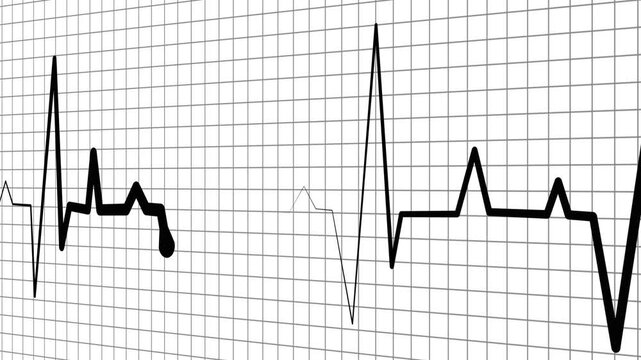 Health heartbeat line showing heart rhythm and medical monitor trace animation
