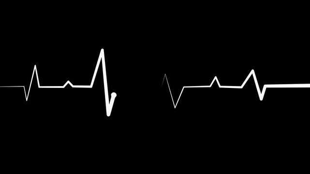 Irregular heartbeat line flat start and end, showing a medical ecg pattern and heart rhythm problem animation