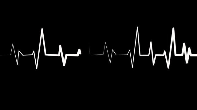 Heartbeat line on graph paper showing an ecg style rhythm pattern animation