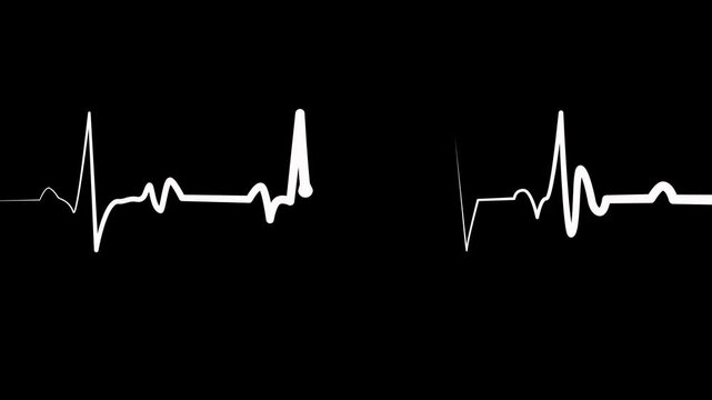 Ecg heartbeat line irregular pulse pattern medical background animation