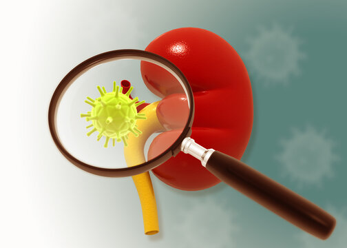 Anatomical human kidney model under a magnifying glass with surrounding virus particles, representing renal infection and medical research.