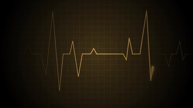 Heartbeat line on a grid pulse pattern for health medicine and emergency monitoring animation