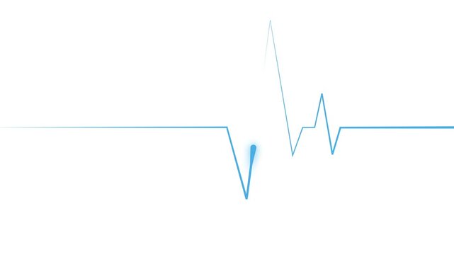 Minimal heartbeat line a medical pulse trace with sharp peaks animation