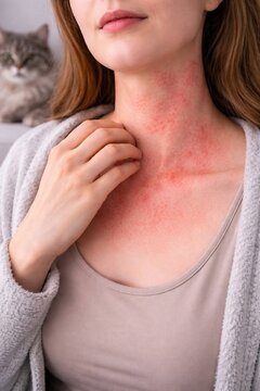 Woman scratching neck with skin allergy rash in presence of cat. Dermatological condition caused by animal dander or pet hair. Medical health issue and symptom of immune response.