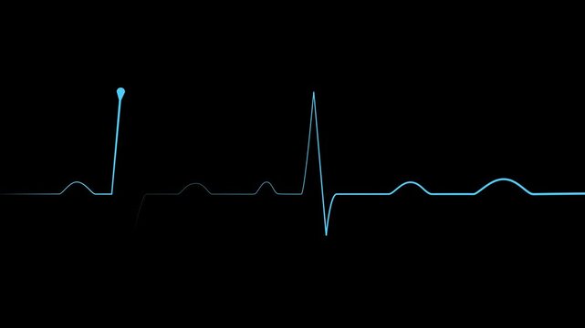 Heartbeat line electrocardiogram style pulse trace with sharp spikes and flat rhythm animation
