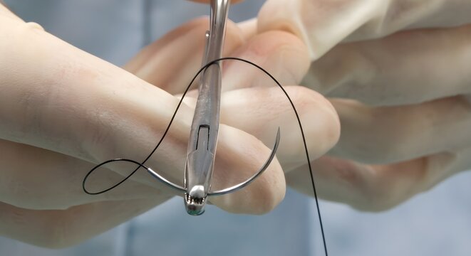 Close-up of surgeon hands holding curved suture needle with needle holder instrument in operating room