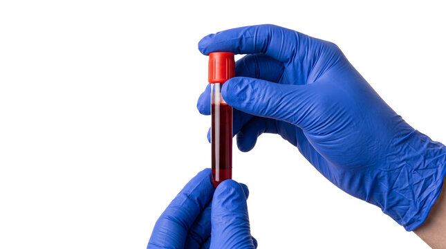 Medical lab technician hands in blue gloves holding blood sample tube isolated on black background for clinical diagnostic testing.