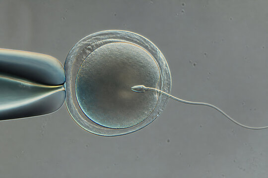 A microscopic view of a single-celled organism, likely an amoeba or similar protist, with a fine filament extending from it.