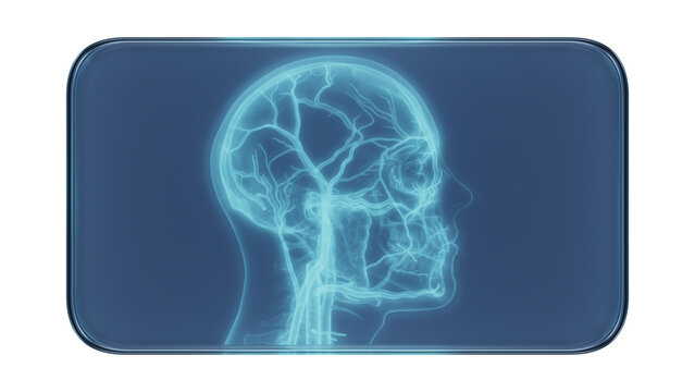 Glass Frame with X-Ray Superficial Arteries and Veins of Face and Scalp Medical Illustration