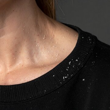 Close up of dandruff flakes on a neck collarbone and sweater
