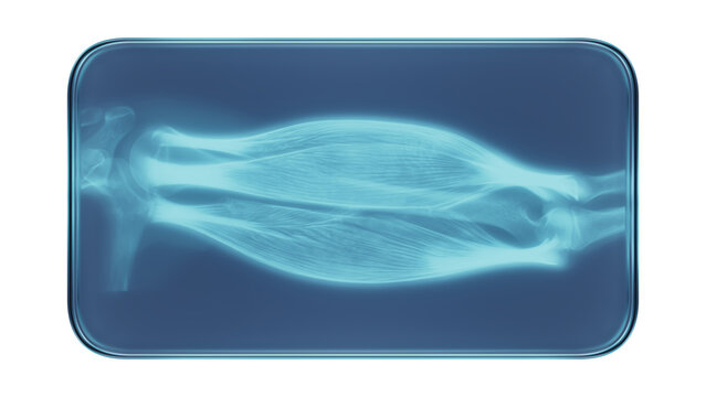Glass Frame with X-Ray Human Arm Muscles Medical Illustration