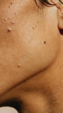 Vertical video: Hand entering right tucking hair behind ear on cheek, revealing stud and papules