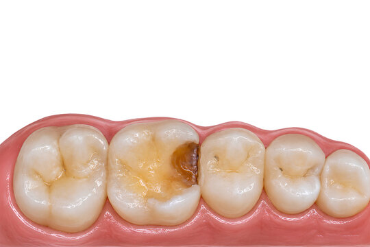 Realistic 3D dental illustration of posterior teeth viewed from an occlusal perspective