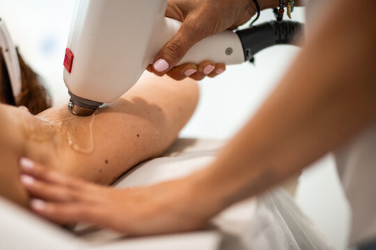 Laser hair removal treatment on female underarm