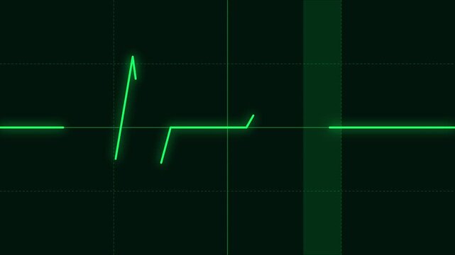 Medical heartbeat ekg monitor pulse line scanning on dark screen animation 4k background