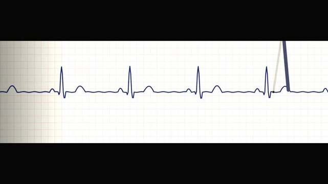Animated Electrocardiogram EKG Heart Rate Monitor Pulse Trace on White Graph Paper Background