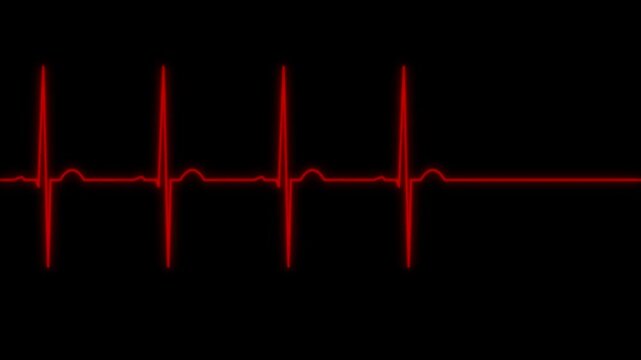 Red EKG ECG Heart Rate Pulse Monitoring Line Animating and Flatlining on a Black Background
