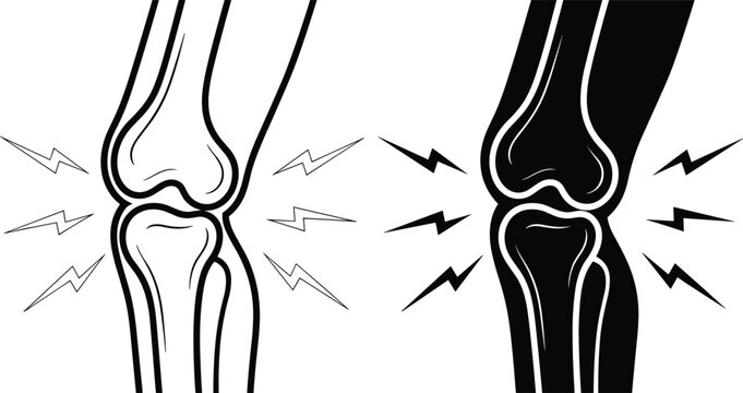 Knee joint pain vector icon set showing human leg bone ache injury arthritis or inflammation with lightning symbols