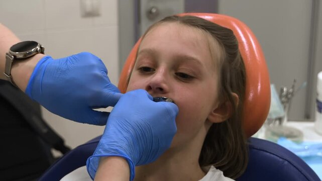 Orthodontist fits impression tray in girl's mouth before dental impression for custom removable orthodontic expansion plate.