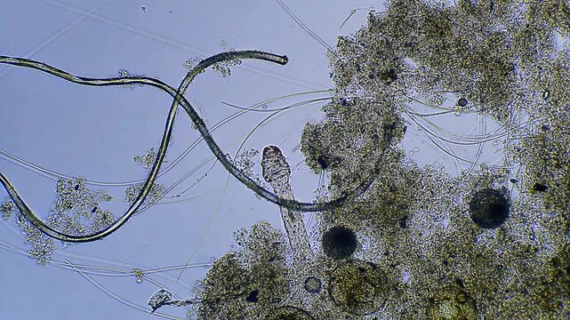 Micro organism - oligochaet bristle worm, microscope magnification