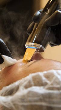 Professional beautician applying cleansing mask on female client's face. Mesotherapy. Close-up of female face during youth restoration and facial rejuvenation procedure.