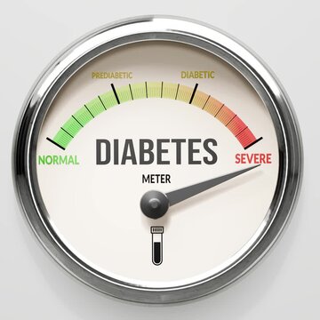 Diabetes - diabetes meter at maximum. High and rising values of diabetes. Meter needle reaching severe levels. Diabetes values off the charts. (No AI, made by humans for humans).