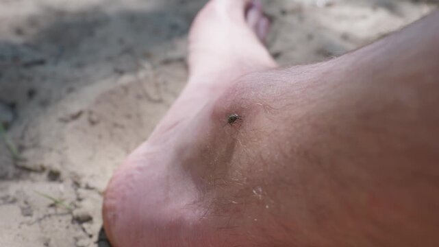 A fly lands on a bare ankle outdoors on dirt ground. This pest hazard highlights the need for insect repellent while camping. Proper pest control prevents insect bites in nature.