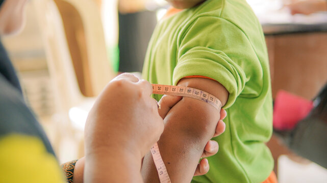 Healthcare worker measuring a child arm circumference for nutritional assessment and health check