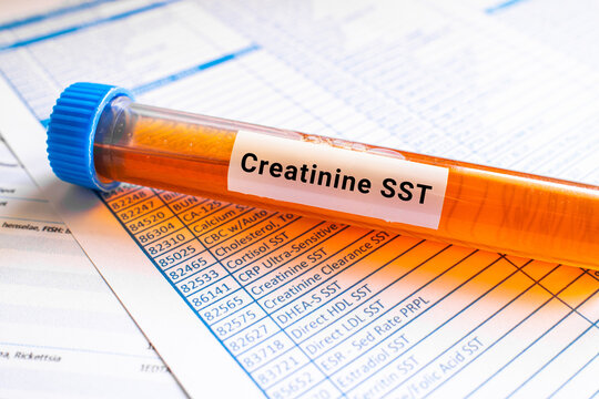 blood sample in lab tube for Creatinine SST test