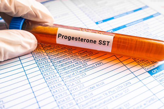 blood sample in lab tube for Progesterone SST test