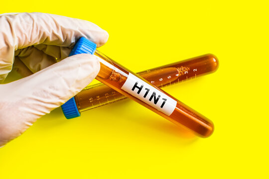 blood sample in lab tube for H1N1 test