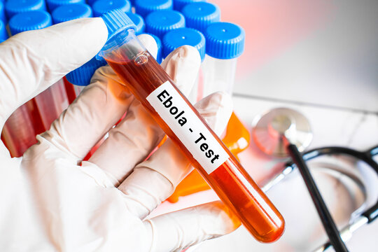 blood sample in lab test tube for Ebola