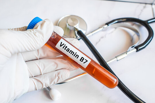 blood sample in lab test tube for Vitamin B7