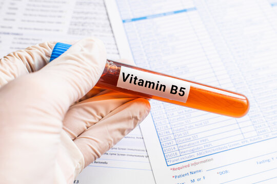 blood sample in lab test tube for Vitamin B5