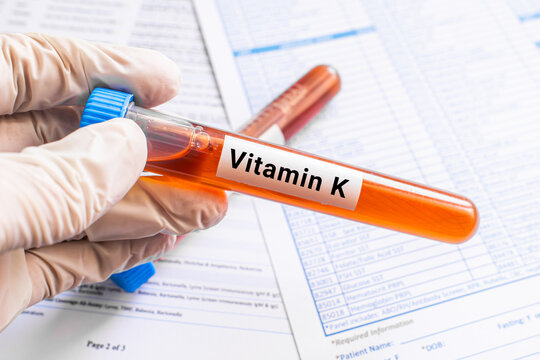 blood sample in lab test tube for Vitamin K