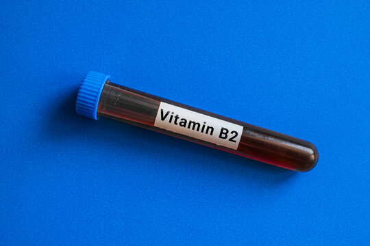 blood sample in lab test tube for Vitamin B2