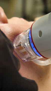A multifunctional device for microneedle RF lifting. Aesthetic procedures for non-surgical lifting, smoothing fine lines, minimizing pores, regulating sebum production, and evening out skin texture.