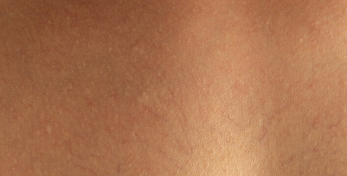Healthy clean brown skin texture material