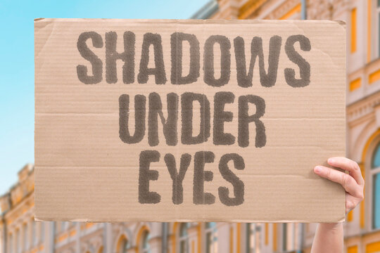 "Shadows under eyes" Bluish tint in tear trough area. BLUISH. TINT. TEAR. TROUGH. AREA.
