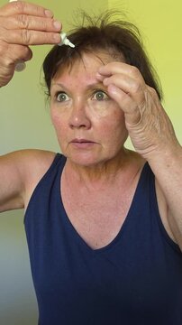 A woman touches her forehead to apply acne treatment.. vertical video.