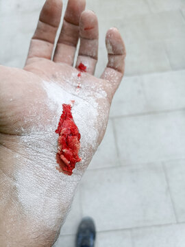 Bleeding cut on a dusty worker hand showing workplace injury, occupational hazards, construction safety risks, and emergency first aid context