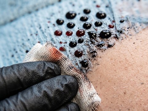 Macro View of Professional Tattoo Process with Ink and Gauze