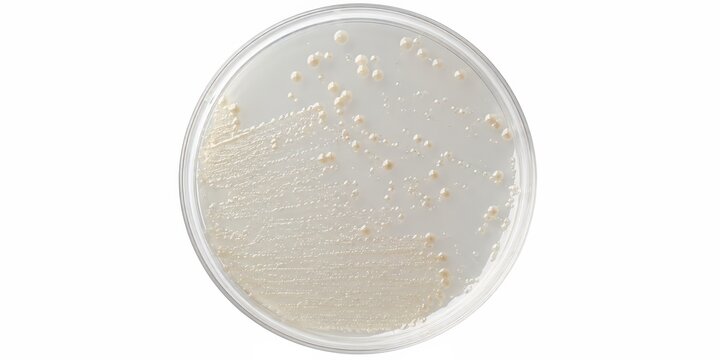 Plastic-degrading bacterial culture growing as cream colonies in a petri dish on white, representing microbiology research, PET biodegradation, enzyme screening and biotechnology for plastic recycling
