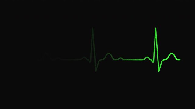 Heartbeat Pulse flatline Animation. Heart electrocardiogram medical screen. Stressful situation. Three Heart Rate. Green heartbeat line on black background. 4K Seamless Loop.