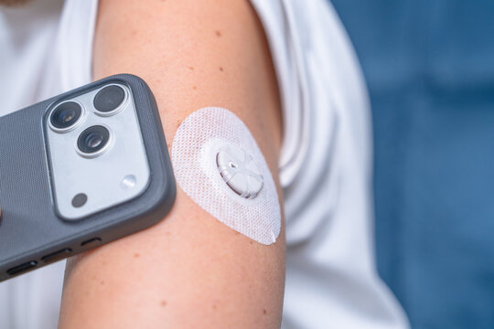 A woman in a white top holds a smartphone near a wearable glucose sensor patch on her upper arm to scan a real time reading, a concept of digital self care and remote monitoring.