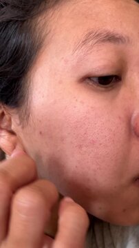 Slow motion vertical close up video of a woman touching her cheek, feeling the onset of blackheads, enlarged pores, and dark spots on her facial skin. Examining skincare concerns.