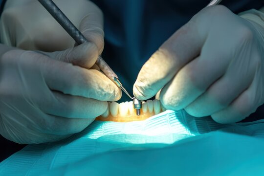 Inserting dental implant crown procedure in human jaw with dental tools view