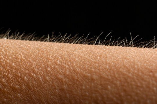 Extreme Close Up of Goosebumps and Raised Arm Hair on Human Skin
