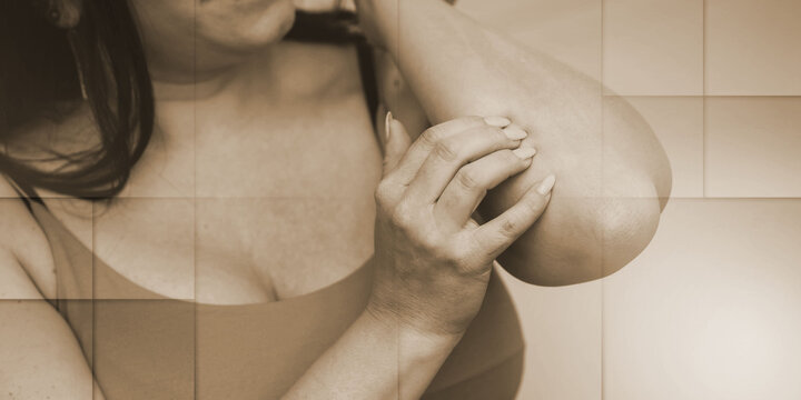 Woman having itchy and scratching her arm, geometric pattern