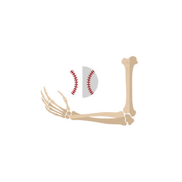 Human arm skeleton reaching for a baseball in a conceptual sports injury illustration.